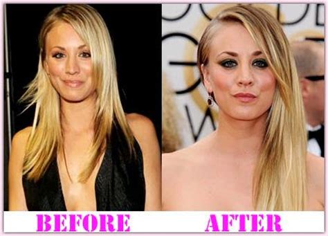 Kaley Cuoco Plastic Surgery Was Done At The Age Of Plastic