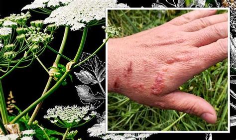 Giant Hogweed Takeover Can Uks Most Dangerous Plant Be Stopped