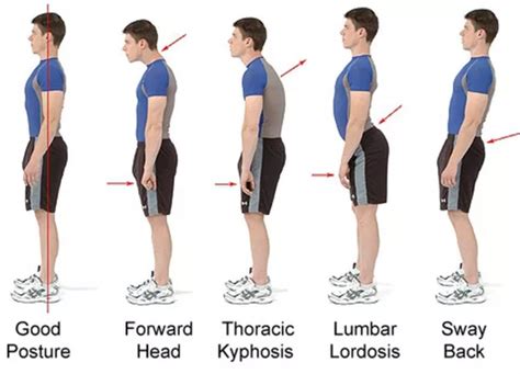 How To Improve Your Posture Naturally Pondic