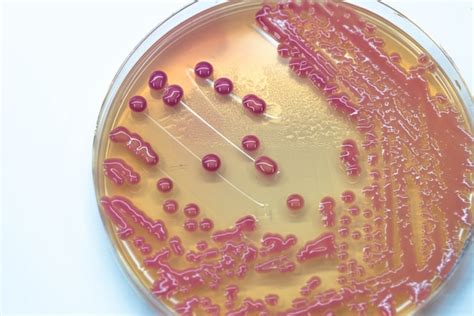 Premium Photo Bacterial Colonies Culture Growth On Agar In Microbiology