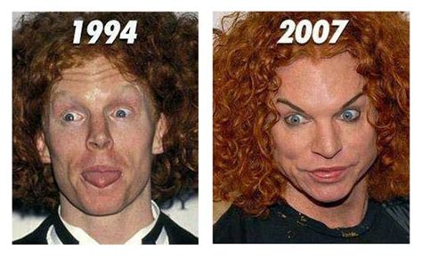 Funny Pictures Before And After Plastic Surgery Plastic
