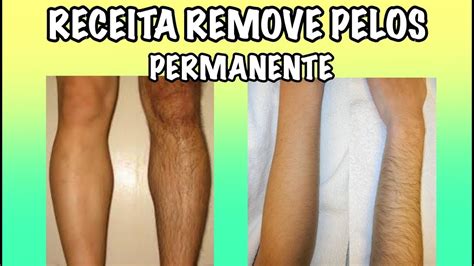 RECEITA REMOVE PELOS FACIAIS PUBIANOS PERNAS E AXILAS PERMANENTE