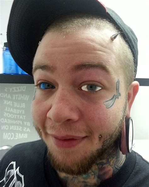 Eyeball Tattoo Gone Wrong Wiki Tattoo