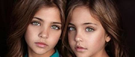 What The Worlds Most Beautiful Twins Look Like Now