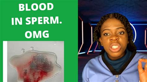 Blood In Sperm Causes Of Blood In The Sperm Semen Hematospermia Youtube