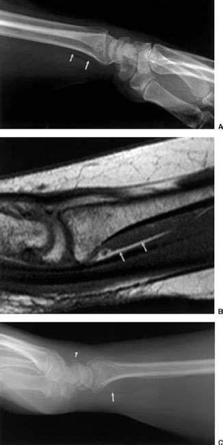 Hand And Wrist Radiology Key