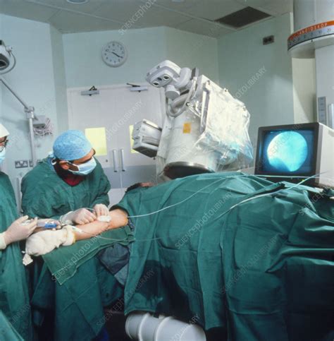 Coronary Angiography Procedure Stock Image M4150053 Science