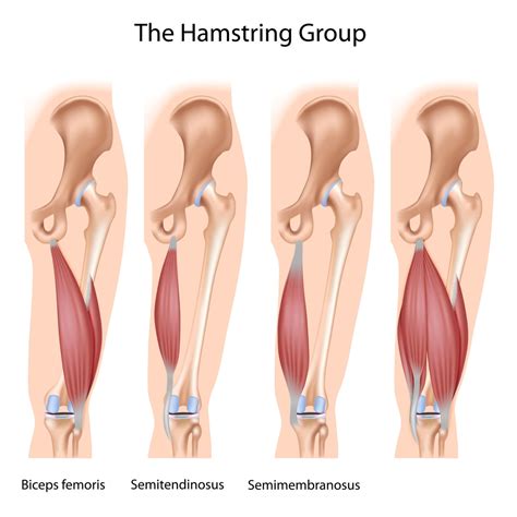 Hamstring Injury Renwick Sports Physiotherapy Orthopaedic Centre