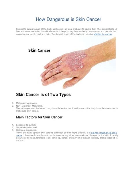 Know Early Signs Of Skin Cancer Dr Vijay Anand Reddy Oncologist India