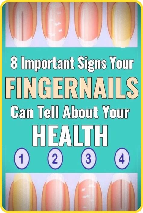 8 Important Signs Your Fingernails Can Tell About Your Health Lines