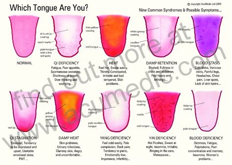 The Granary Tuesdays Ten 10 Reasons To Use A Tongue Scraper