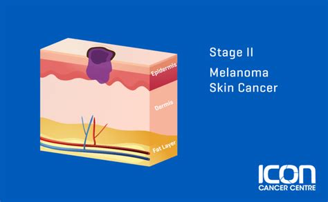 What Is Melanoma Melanoma Explained Icon Cancer Centre