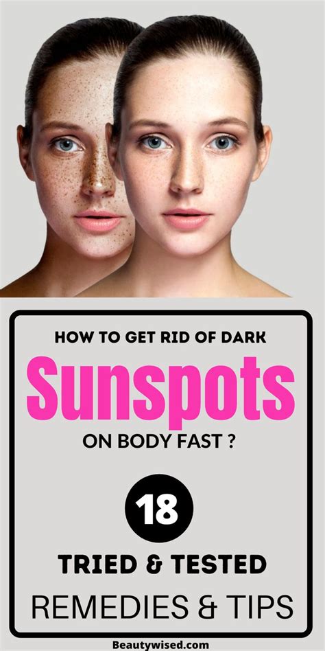 Pin On Get Rid Of Sunspots On Your Face Arms Legsandskin