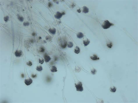Microscopic Examination Of Aspergillus Fumigatus A 10× Download