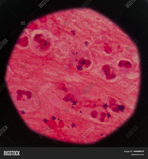 Gram Stain Showing Image And Photo Free Trial Bigstock