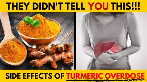 Terrible Side Effects Of Too Much Turmeric Youtube