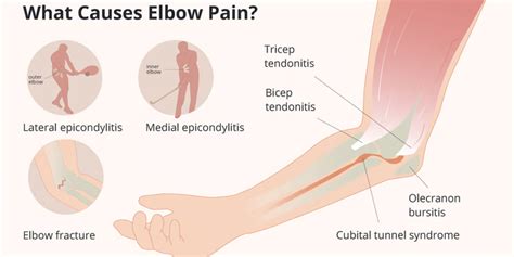 Causes Of Elbow Pain And Treatment Options Impulse Today