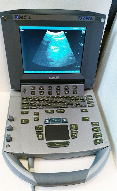 Sonosite Titan Portable Ultrasound System Module Only Diagnostic