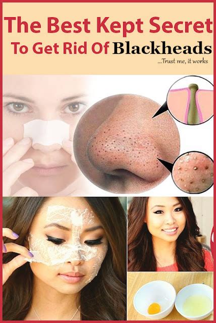 Get Fit Girls The Best Kept Secrets To Get Rid Of Blackheads