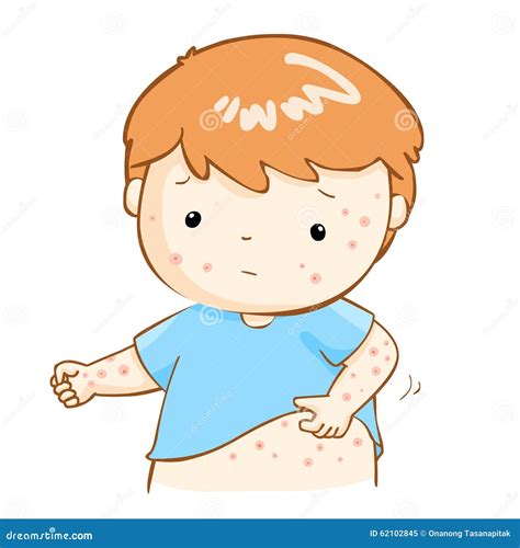Boy Scratching Itching Rash On His Body Stock Vector Image 62102845