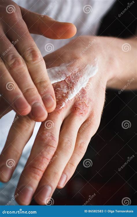 Cropped Image Of A Young Man Putting Moisturizer Onto His Hand With