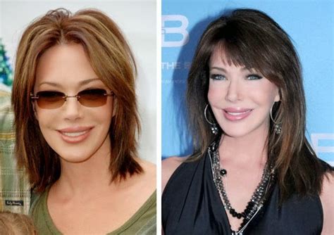 Hunter Tylo Plastic Surgery Before And After Photos Boob Job Nose Job And Lips