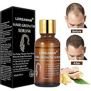 Try volumizing shampoos and conditioners as alternatively, try rogaine, which is an fda approved topical treatment that slows hair loss and may stimulate new hair growth. Best Hair Loss ReGrowth Serum Oil Treatment with 16 ...