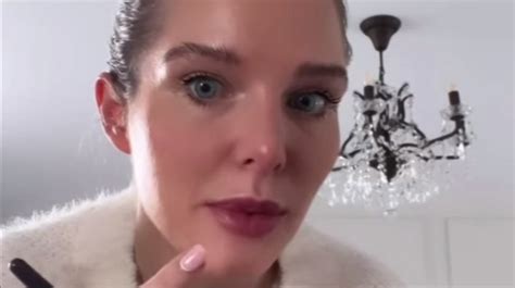 Helen Flanagan Gets Lip Filler And Platinum Hair After Boob Job In