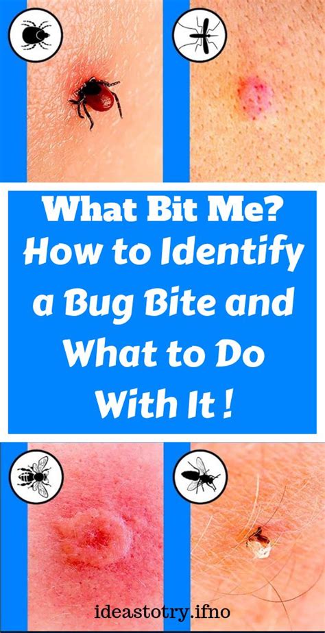 How To Identify A Bug Bite And What To Do With It With Images