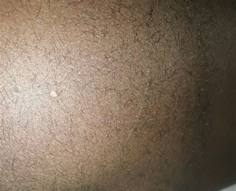 Strange Unexplained Markings On My Body Religion Nigeria