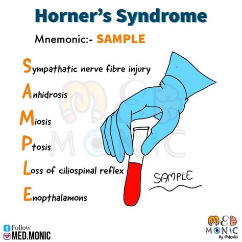 Medmonic S Instagram Photo Horner S Syndrome Follow For