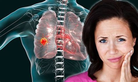 Lung Cancer Symptoms Signs To Look For Include Swollen Face