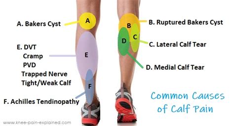 Calf Muscle Pain Causes And Treatment Knee Pain Explained 2022