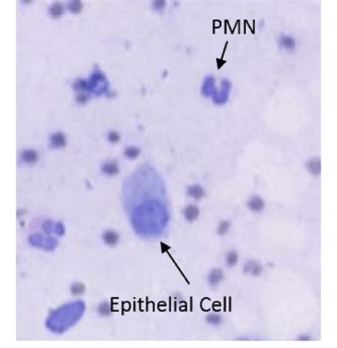 Epithelial Cell Compared To A Polymorphonuclear Neutrophil Pmn Download Scientific Diagram