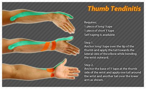 Kinesiology Taping Instructions For Tendinitis Of The Thumb Ktape