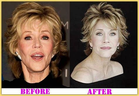 In certain interview, she openly admitted that she had been under knife for breast implants to increase the volume of her cup size. Jane Fonda Plastic Surgery - Plastic Surgery and Nose Job