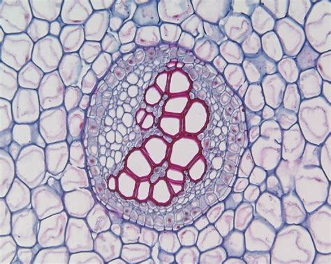 Vascular Bundle In Stem