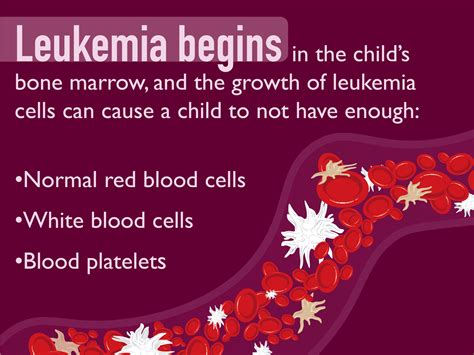 Each of the four major types of leukemias have different presentation, signs and symptoms. Pediatric Leukemia Symptoms and Signs | Dana-Farber Cancer ...