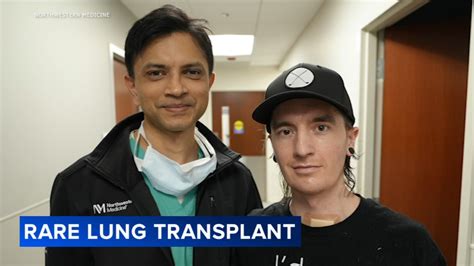 Double Lung Transplant Northwestern Surgeons Replace Mans Lungs With