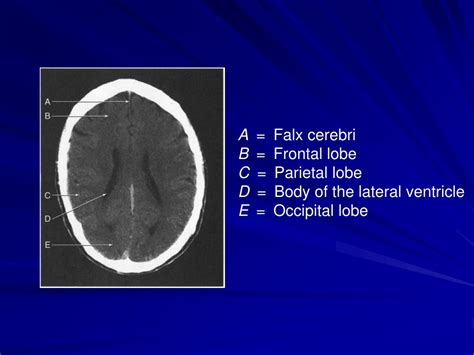 Ppt Neuroradiology For Medical Students Powerpoint Presentation Free