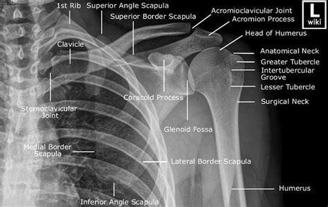Muscles of the arm and shoulder (labeled diagram). Shoulder girdle radiograph | Medical anatomy, Radiology ...
