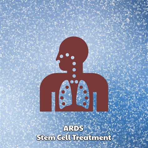Ards Stem Cell Treatment Dreambody Clinic