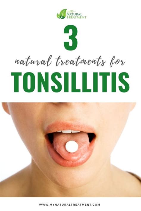 3 Natural Treatments For Tonsillitis
