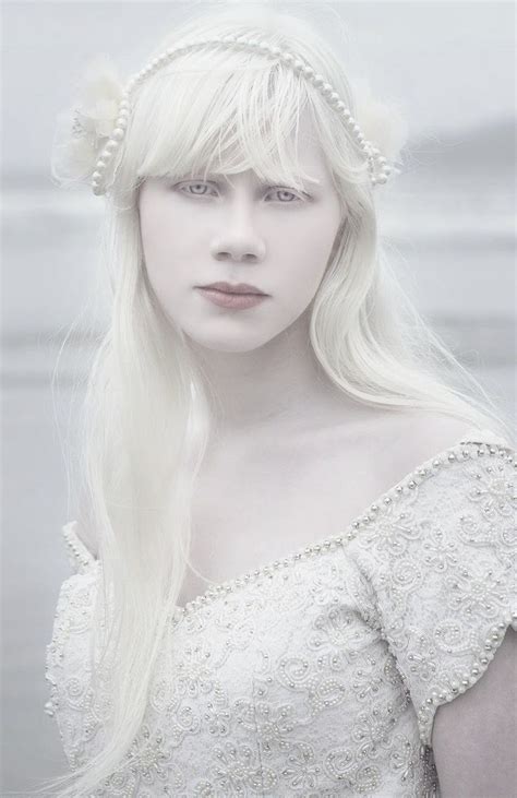 Albinism Is Beautiful Beauty Of Albinism Albino Woman Albinism Women Beauty Beautiful
