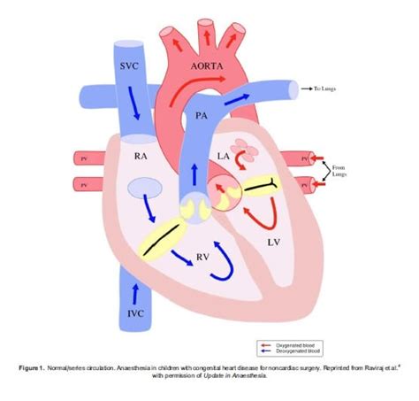 Anaesthesia In Children With Congenital Heart Disease For Noncardiac