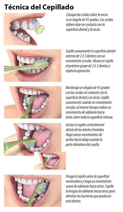 Sabe Cu L Es El Cepillo Dental Correcto Para Usted Dental Clinic Dentists In Tijuana