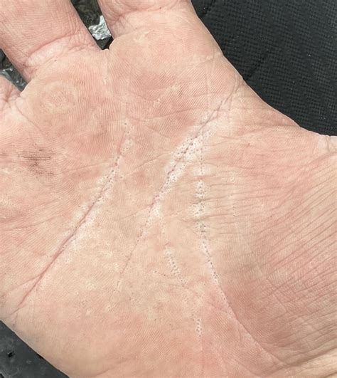 My Hand Had A Million Small Holes After A Day Working Construction In