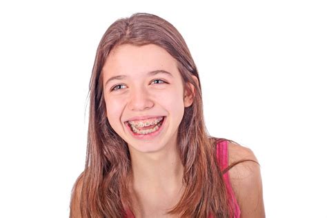 Orthodontic Options How To Choose The Best Braces For You Guidelines Health