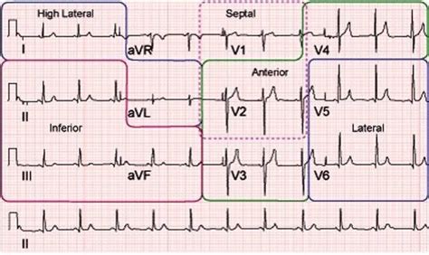 Ecg Leads And The Corresponding Areas Of The Heart Cardiology Nursing