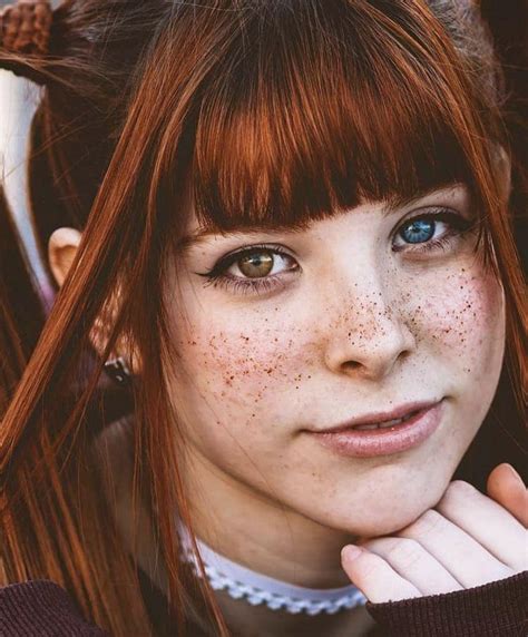 redhead freckles r welovefreckles
